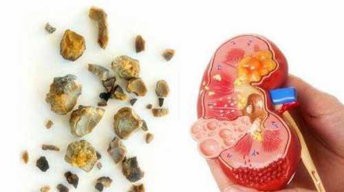 薅慜陕西供卵费用,陕西赠卵试管婴儿的医院