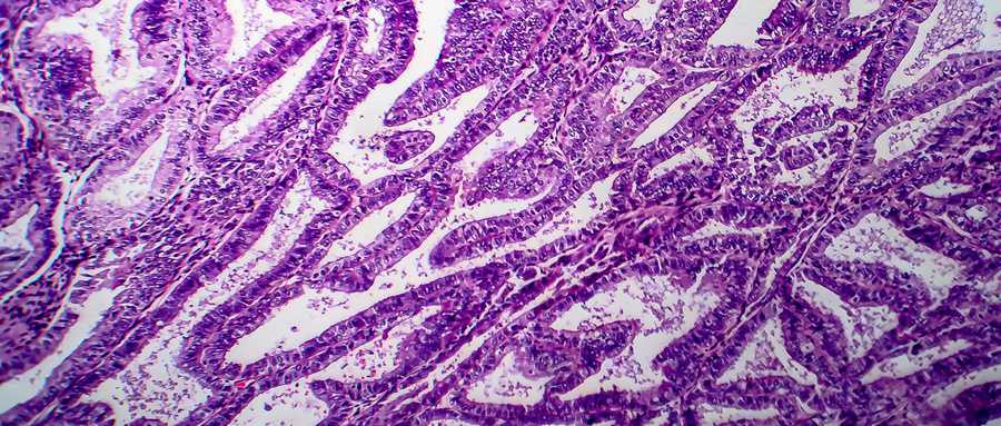 西安试管好供卵嘛,试管婴儿囊胚好培养吗_西安公立的供卵医院