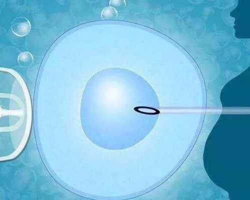 代生温州代生妇 温州二院试管婴儿医生评价 ‘怀孕初期孕囊看男女准确率’